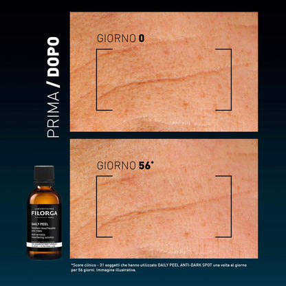 Filorga Daily Peel Anti-Wrinkles – Soluzione Esfoliante Antirughe