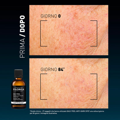 Filorga Daily Peel Anti-Dark Spots – Soluzione Esfoliante Anti-Macchie